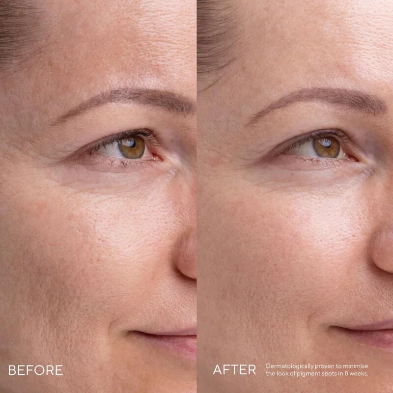 Mádara MÁDARA Kojic Alternative Pigment Serum sérum proti pigmentovým skvrnám 30 ml