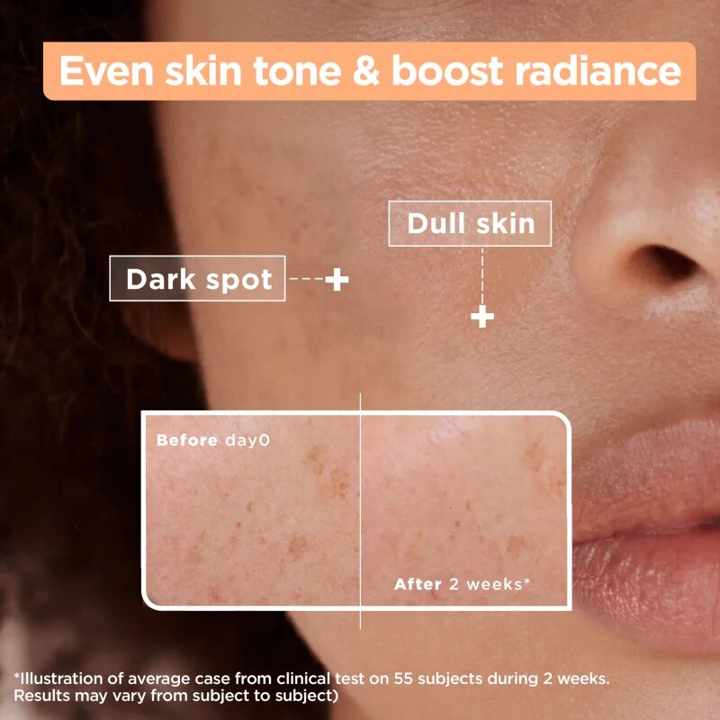 MIXA Anti-Dark Spot sérum proti pigmentovým skvrnám 30 ml
