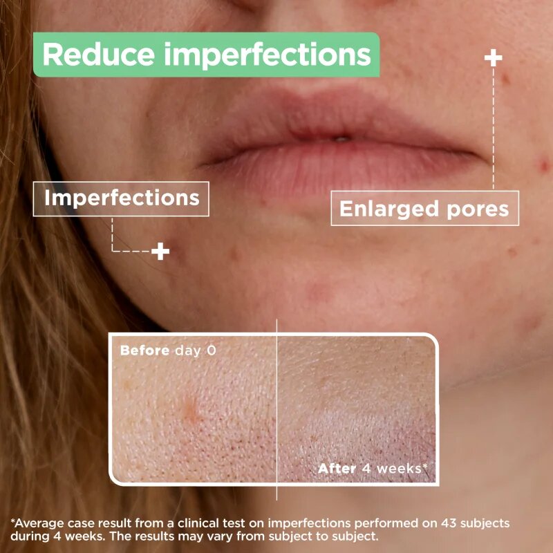 MIXA Anti-Imperfection sérum pro problematickou pleť akné 30 ml