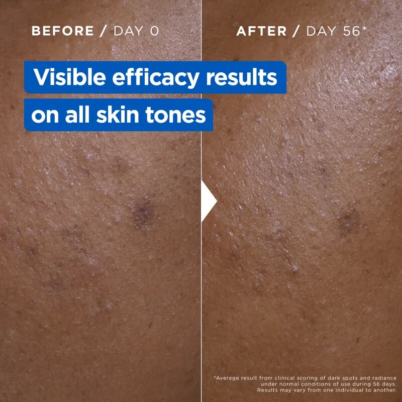 MIXA Niacinamide Bright intenzivně hydratační krém proti tmavým skvrnám 400 ml