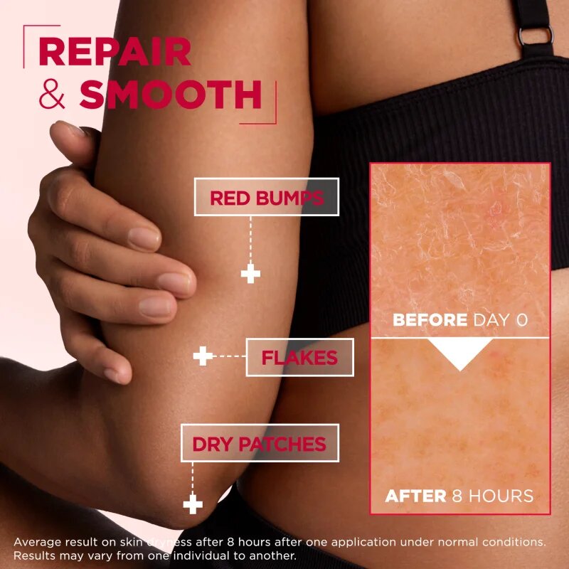 MIXA Urea Cica Repair+ regenerační tělový krém pro velmi suchou pokožku 150 ml