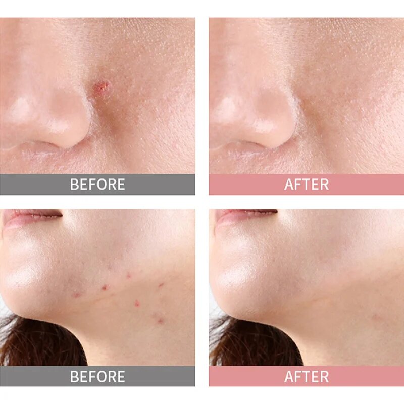 Mizon Good Bye Blemish Pink Spot lokální sérum s pudrem proti akné 19 ml