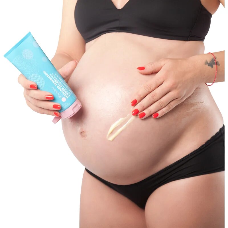 MomCare by Lina Anti-Stretch Mark Cream tělový krém na strie 200 ml
