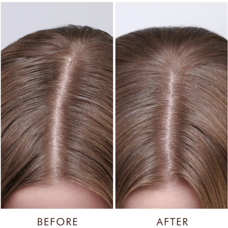 Moroccanoil Scalp Dry Scalp Treatment hloubkově vyživující kúra pro suchou pokožku 45 ml