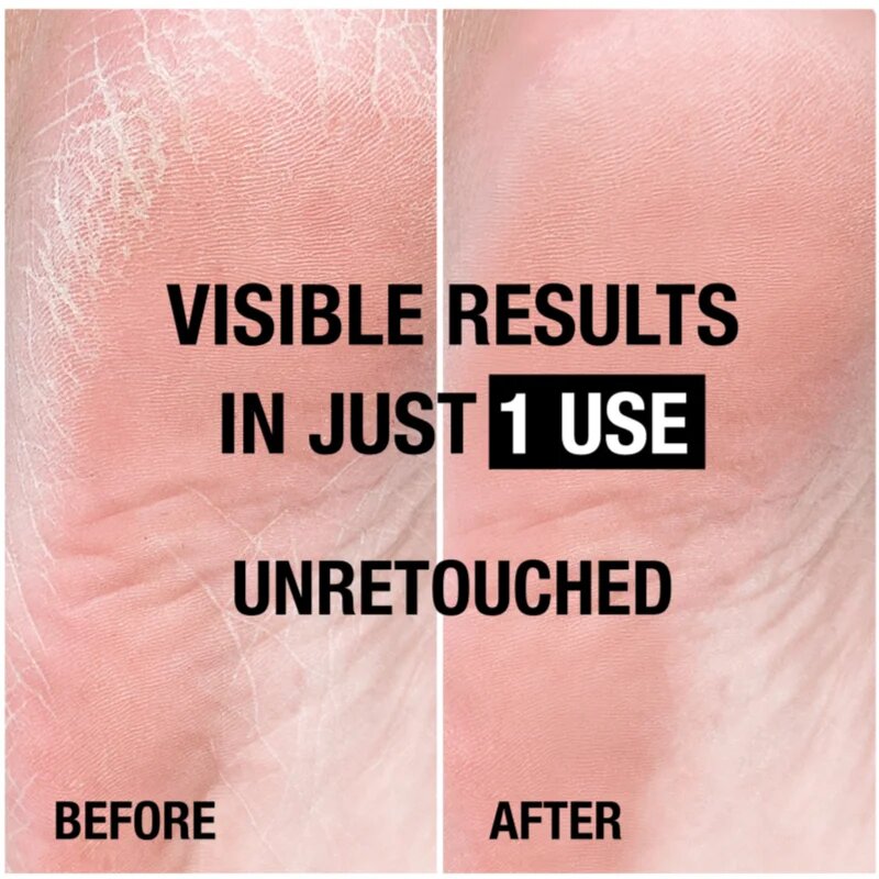 Neutrogena Norská receptura® výživný krém na chodidla 100 ml