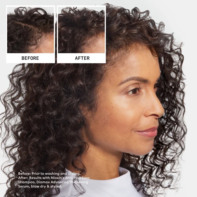 Nioxin Anti-Hair Loss Shampoo šampon proti padání vlasů 240 ml