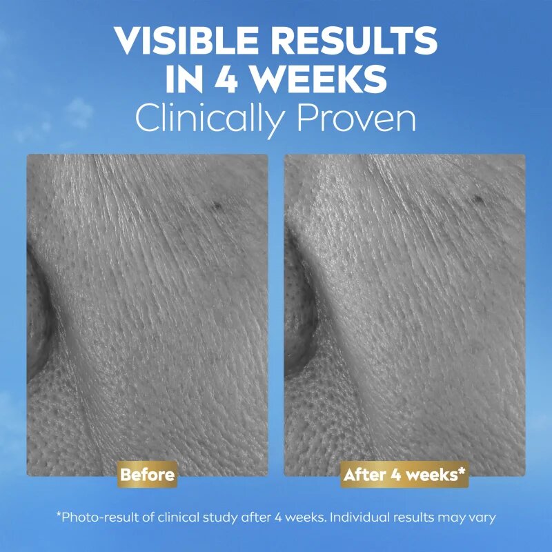 Nivea Q10 Anti-Wrinkle Collagen Expert protivráskové sérum s kolagenem 30 ml