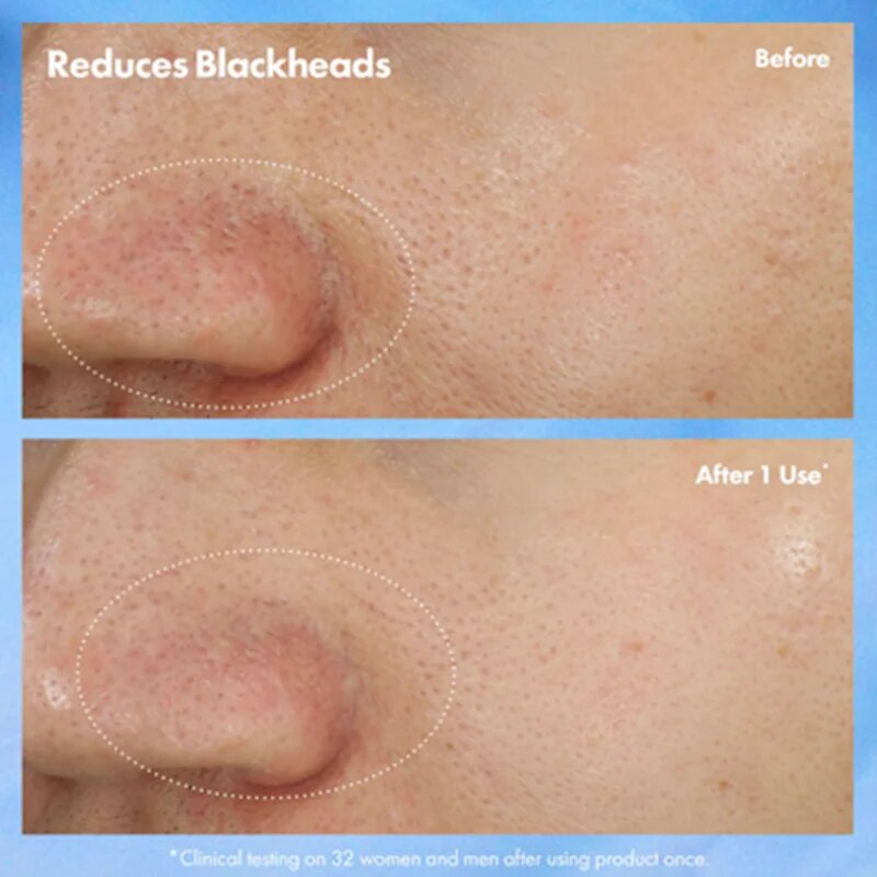 Origins Clear Improvement® Blackhead Clearing Mask-To-Scrub maska na čištění pórů proti černým tečkám 75 ml