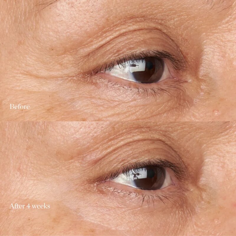 Perricone MD Hypoallergenic Clean Correction Eye Cream hydratační a rozjasňující péče na oční víčka a kruhy pod očima 15 ml