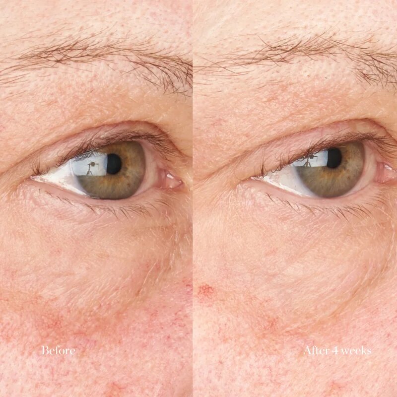 Perricone MD Hypoallergenic Clean Correction Eye Cream hydratační a rozjasňující péče na oční víčka a kruhy pod očima 15 ml