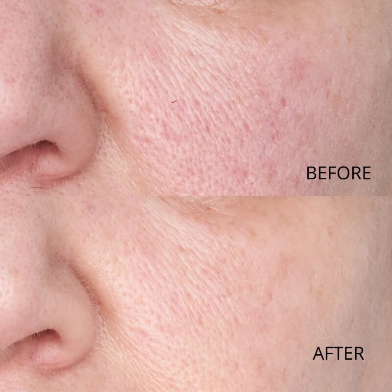 Perricone MD Hypoallergenic Clean Correction Smoothing Restorative Serum vyhlazující sérum pro hydrataci a rozjasnění pleti 59 ml