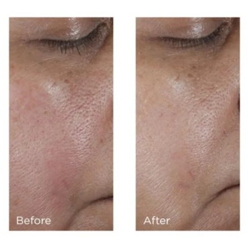 Perricone MD No:Rinse Pore Minimizing Toner intenzivní tonikum pro vyhlazení pleti a minimalizaci pórů 118 ml