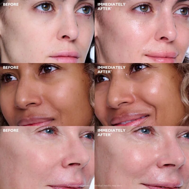 Peter Thomas Roth Collagen Skinjection™ Plumping & Firming Serum intenzivně zpevňující sérum s kolagenem 30 ml