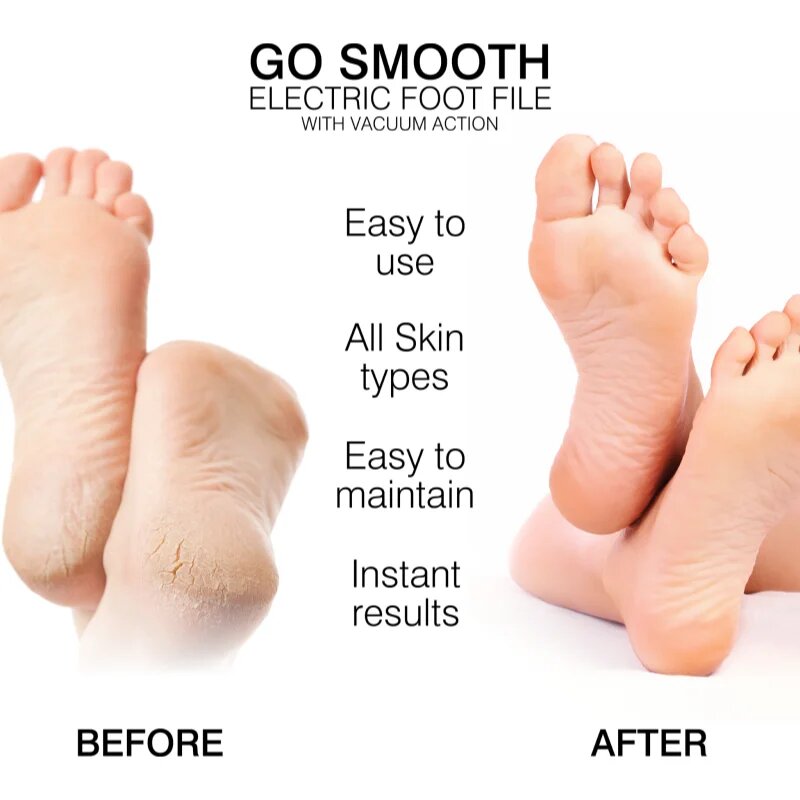 RIO Go Smooth Vacuum Action elektrický pilník na chodidla 1 ks