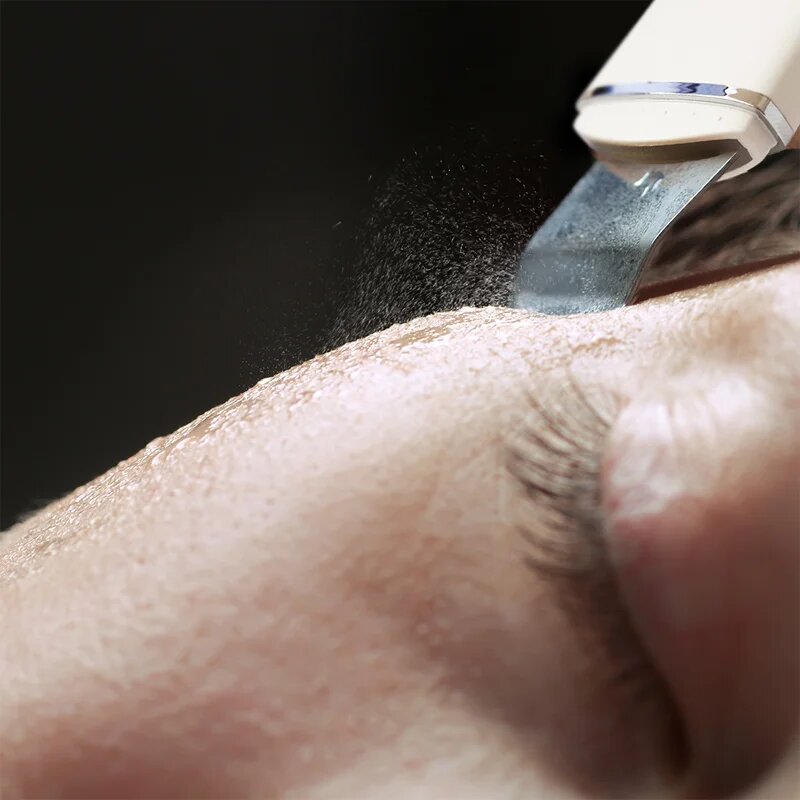 RIO Ultrasonic Skin Cleanser multifunkční ultrazvuková špachtle 1 ks