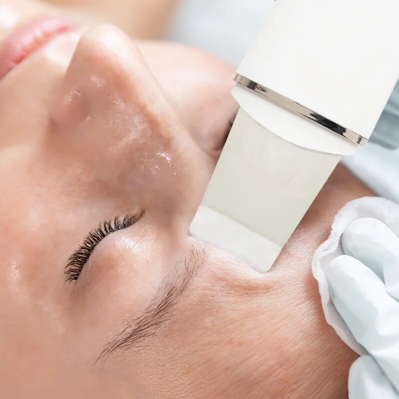 RIO Ultrasonic Skin Cleanser multifunkční ultrazvuková špachtle 1 ks