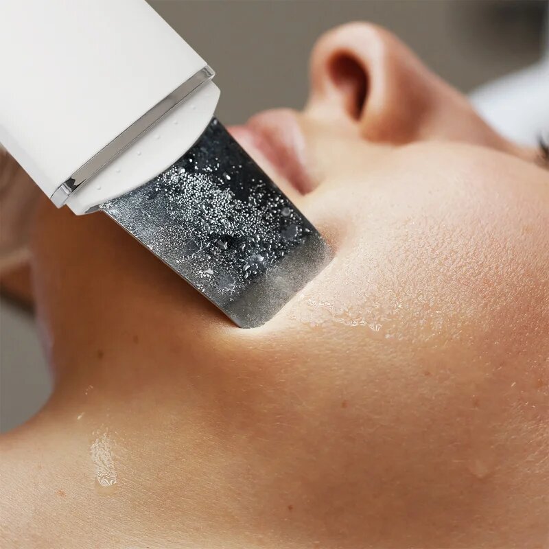RIO Ultrasonic Skin Cleanser multifunkční ultrazvuková špachtle 1 ks