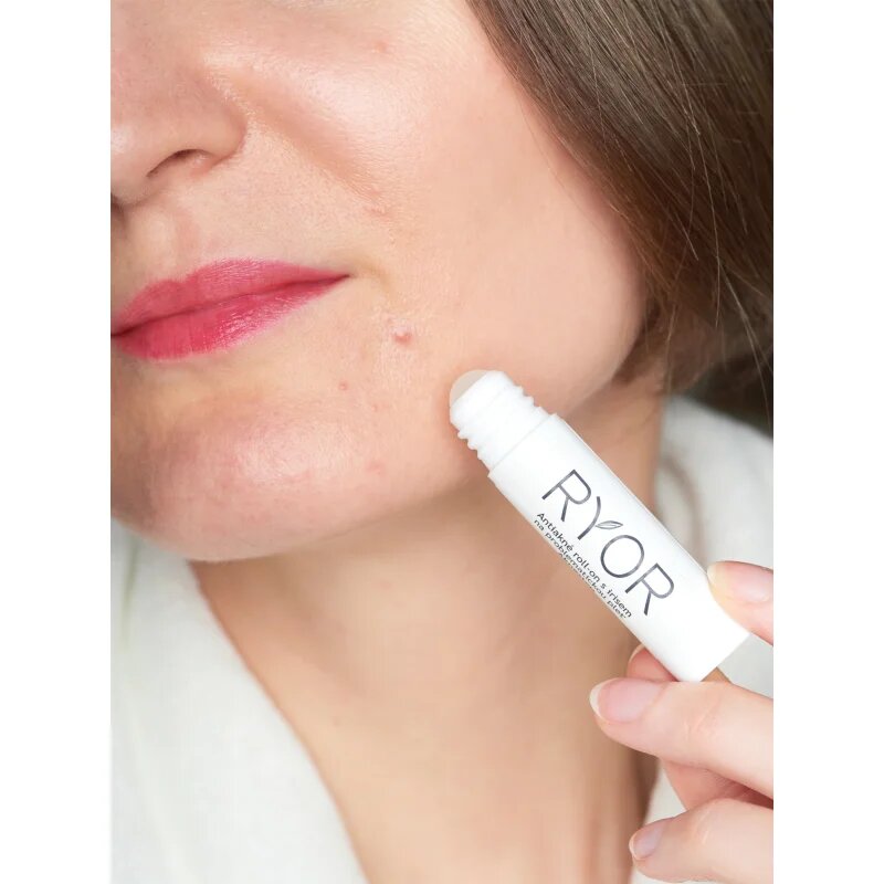 RYOR Aknestop roll-on pro problematickou pleť 5 ml