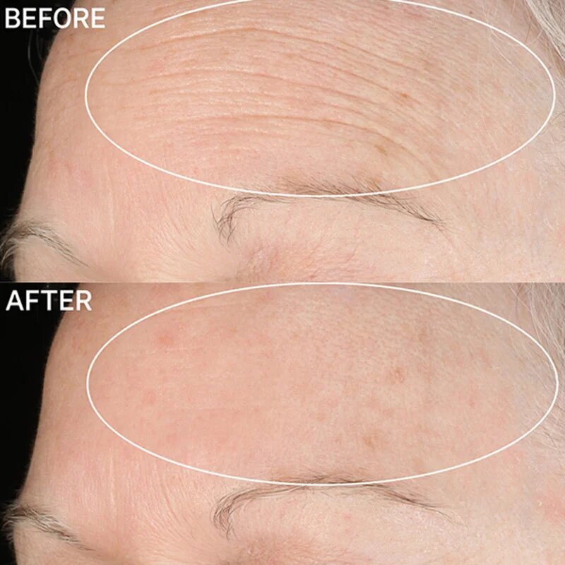 StriVectin Anti-Wrinkle SD Advanced Plus koncentrovaný krém redukující vrásky 118 ml