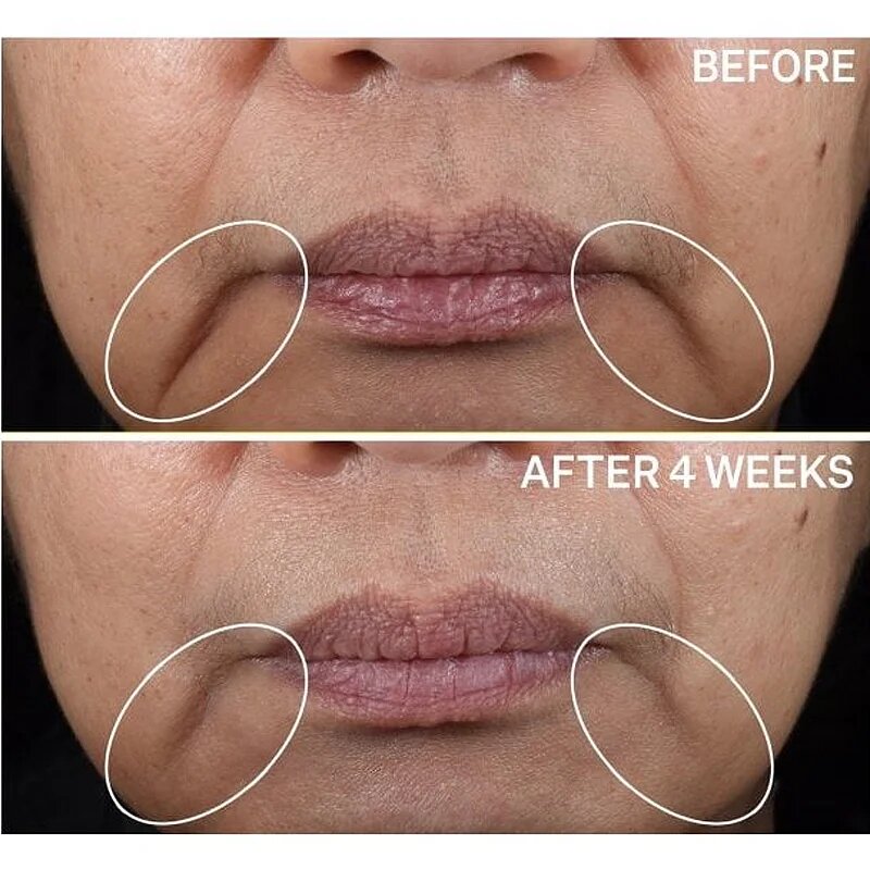 StriVectin Contour Restore™ Tightening & Sculpting Face Cream ultra liftingový pleťový krém 50 ml