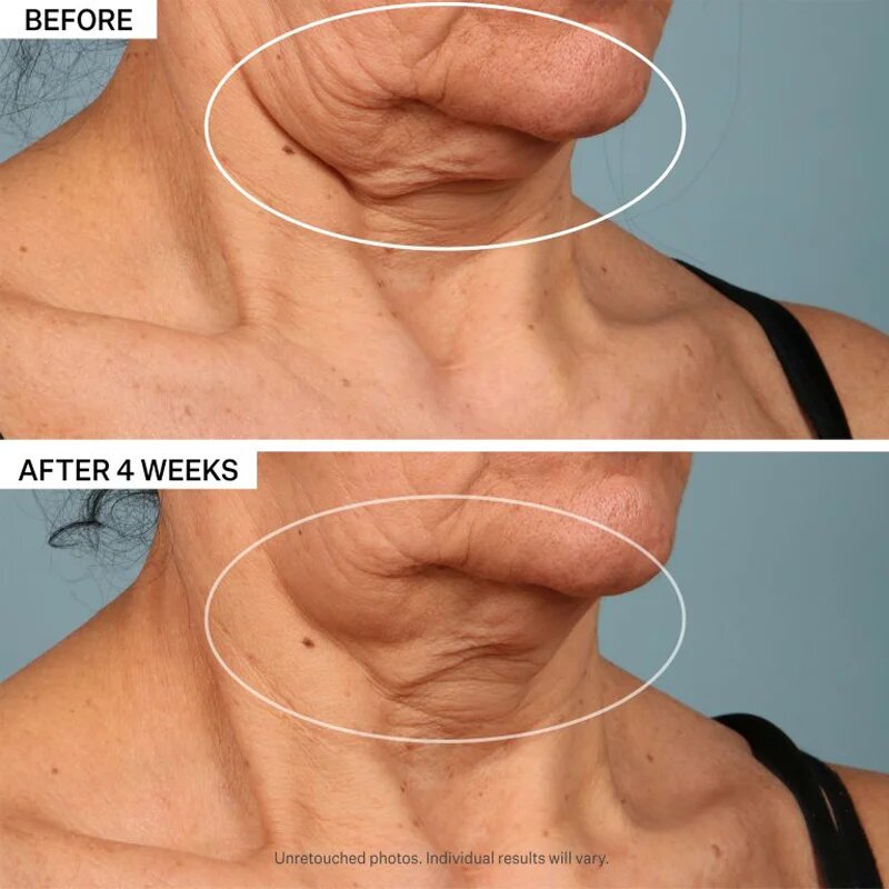 StriVectin Tighten & Lift TL Advanced Tightening Neck Cream Plus liftingový zpevňující krém na krk a dekolt 30 ml