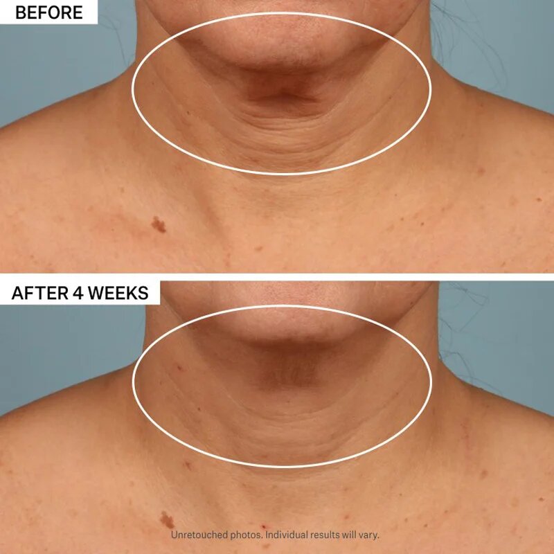 StriVectin Tighten & Lift TL Advanced Tightening Neck Cream Plus liftingový zpevňující krém na krk a dekolt 50 ml