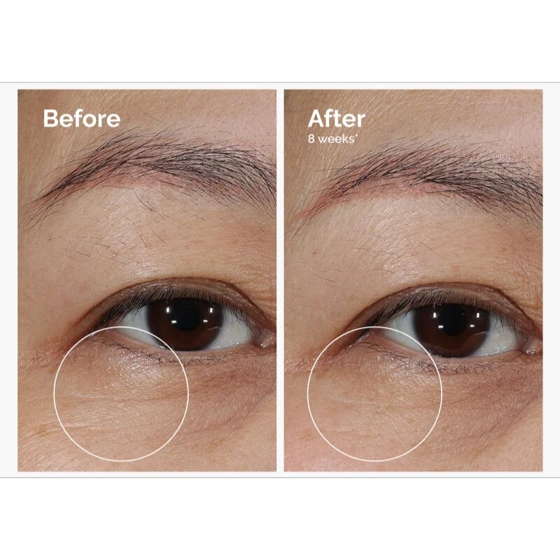 The Ordinary Lacto-PDRN* 4% + B9 Eye Cream vyhlazující oční krém proti vráskám očního okolí 15 ml