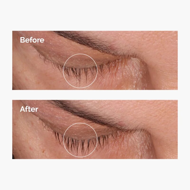 The Ordinary Multi-Peptide Lash and Brow Serum sérum na řasy a obočí 5 ml