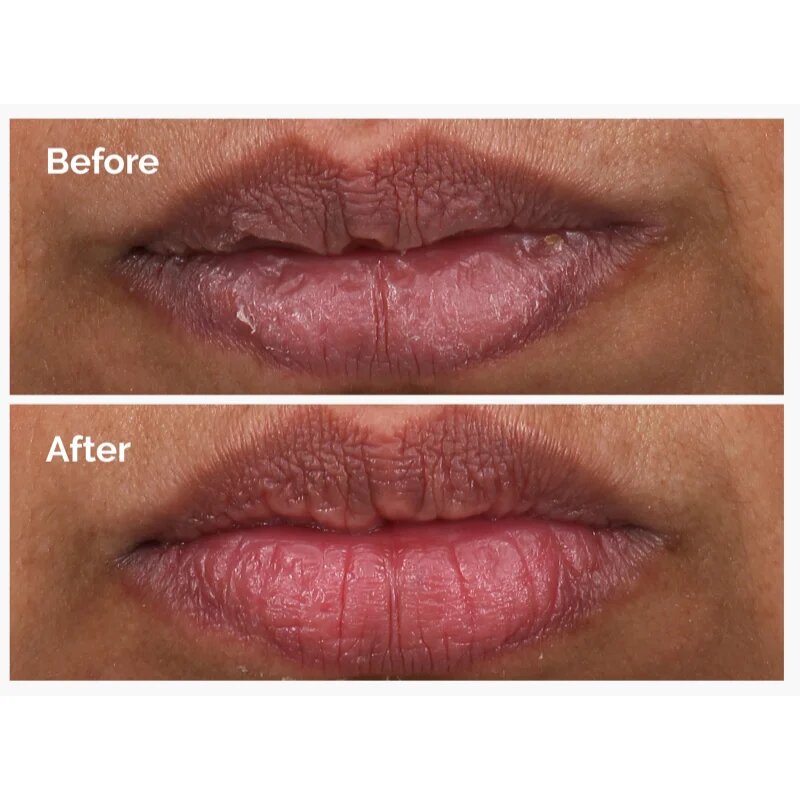The Ordinary PHA 5% Exfoliating Lip Serum vyhlazující exfoliační sérum na rty 15 ml