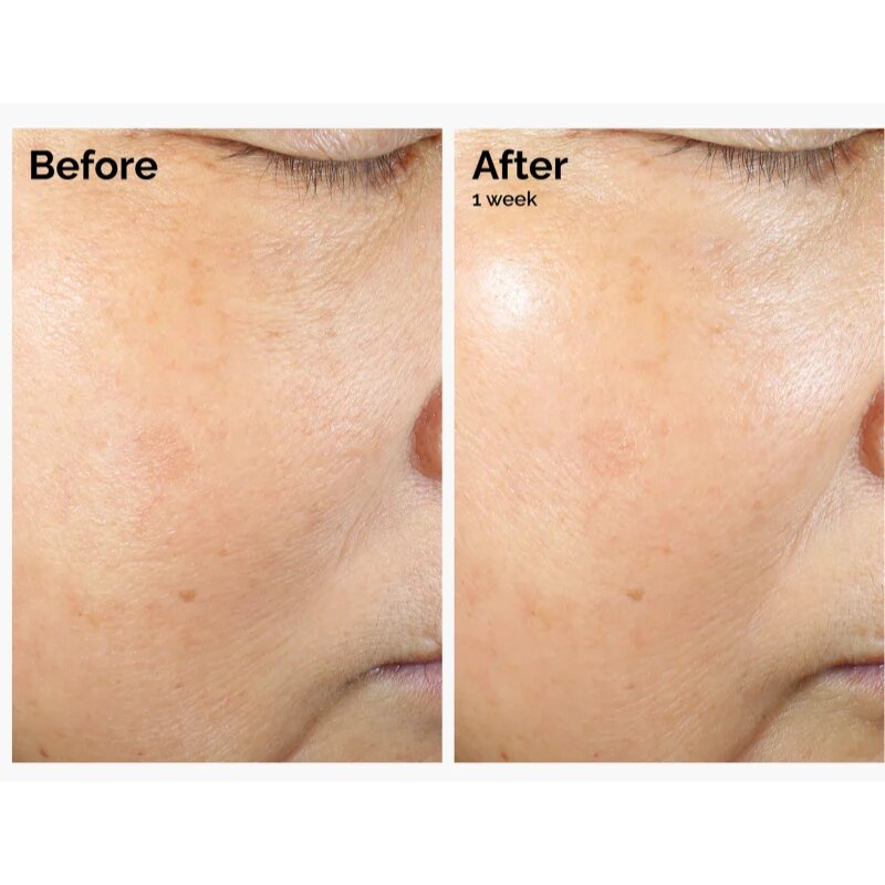 The Ordinary Rice Lipids + Ectoin Microemulsion lehká hydratační emulze pro zklidnění pleti 60 ml