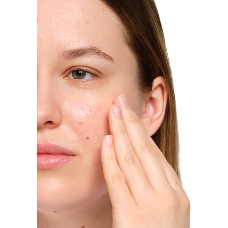 The Ordinary Salicylic Acid 2% Anhydrous Solution pleťové sérum pro jednotný tón pleti 30 ml
