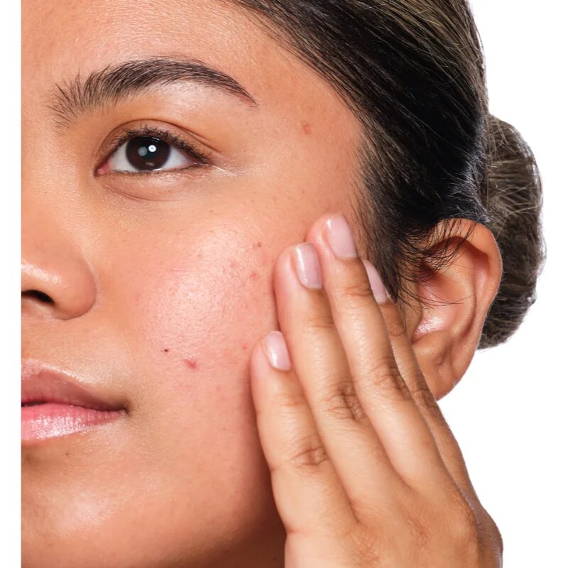 The Ordinary Salicylic Acid 2% Solution sérum s kyselinou salicylovou 30 ml