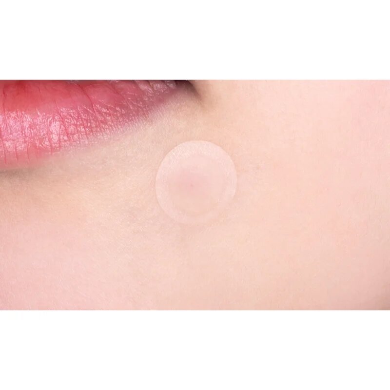VT Cosmetics Cica Spot Patch náplasti na problematickou pleť 48 ks