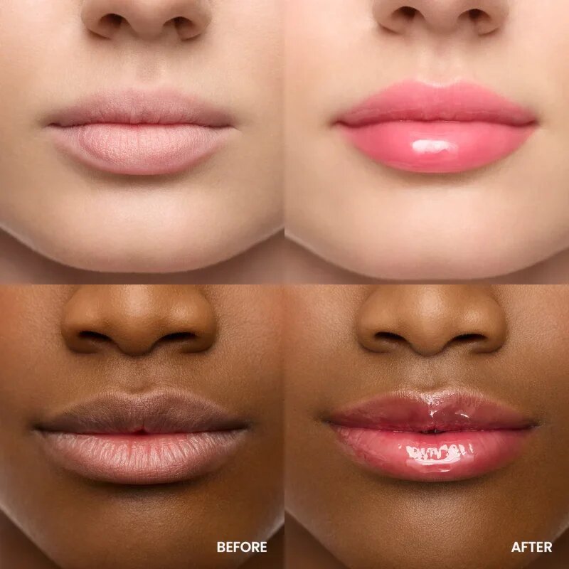 WONDERSKIN Lip Rehab Serum Oil olej na rty odstín amour 3.57 ml