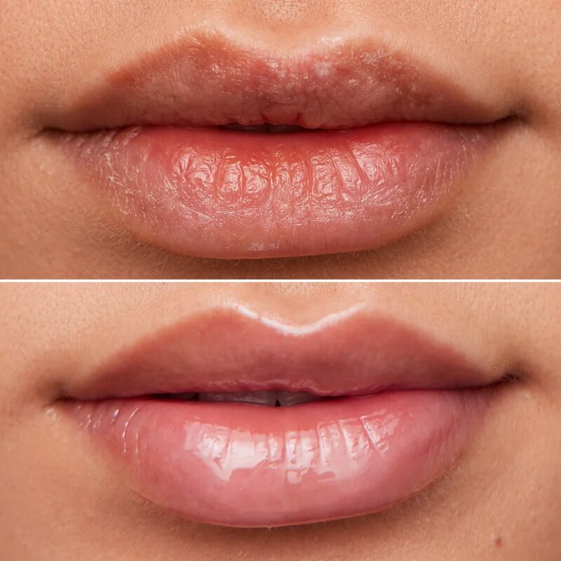 WONDERSKIN Lip Rehab Therapy Oil olej na rty s hydratačním účinkem odstín Clear 357 ml