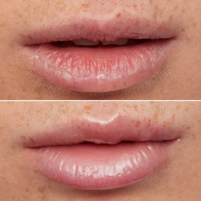 WONDERSKIN Lip Rehab Therapy Oil olej na rty s hydratačním účinkem odstín Clear 357 ml